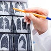 lung cancer screening LDCT images with white coated hand pointing at them orange pen